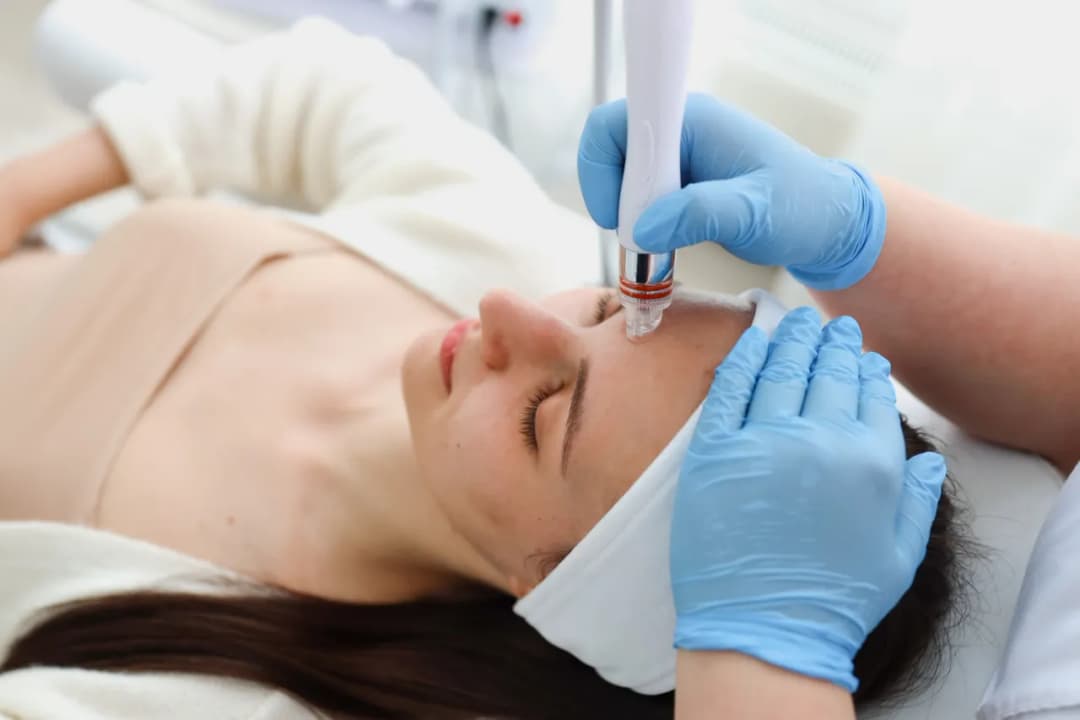 Oczyszczanie wodorowe czy mikrodermabrazja: co wybrać dla swojej skóry?