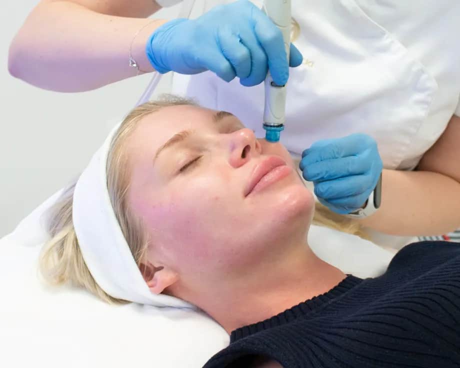 Jak wygląda twarz po mikrodermabrazji? Efekty i co warto wiedzieć